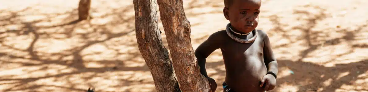 A starving child in Africa.